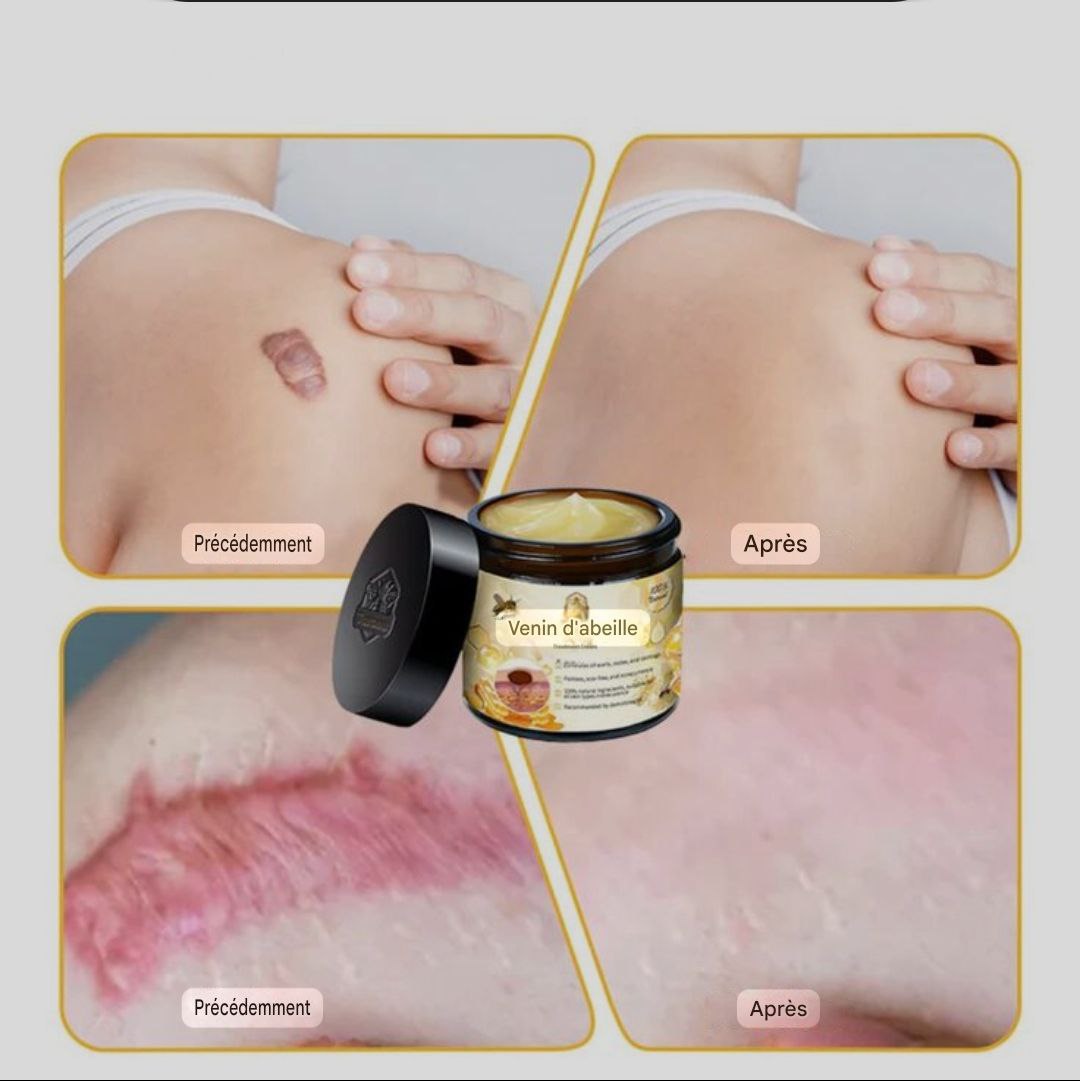 crème au venin d'abeille