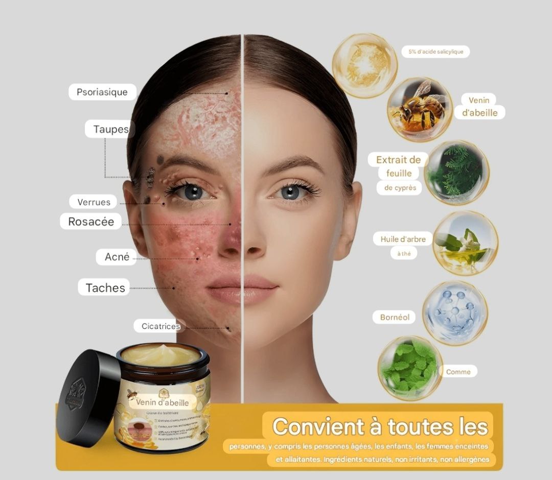 crème au venin d'abeille éliminez une large game de problèmes de peau