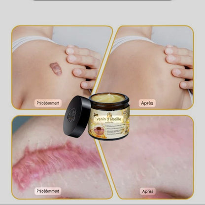crème au venin d'abeille