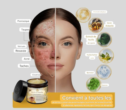 crème au venin d'abeille
